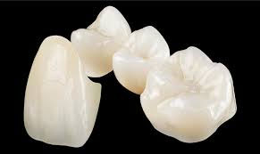 Ceramic dental crown