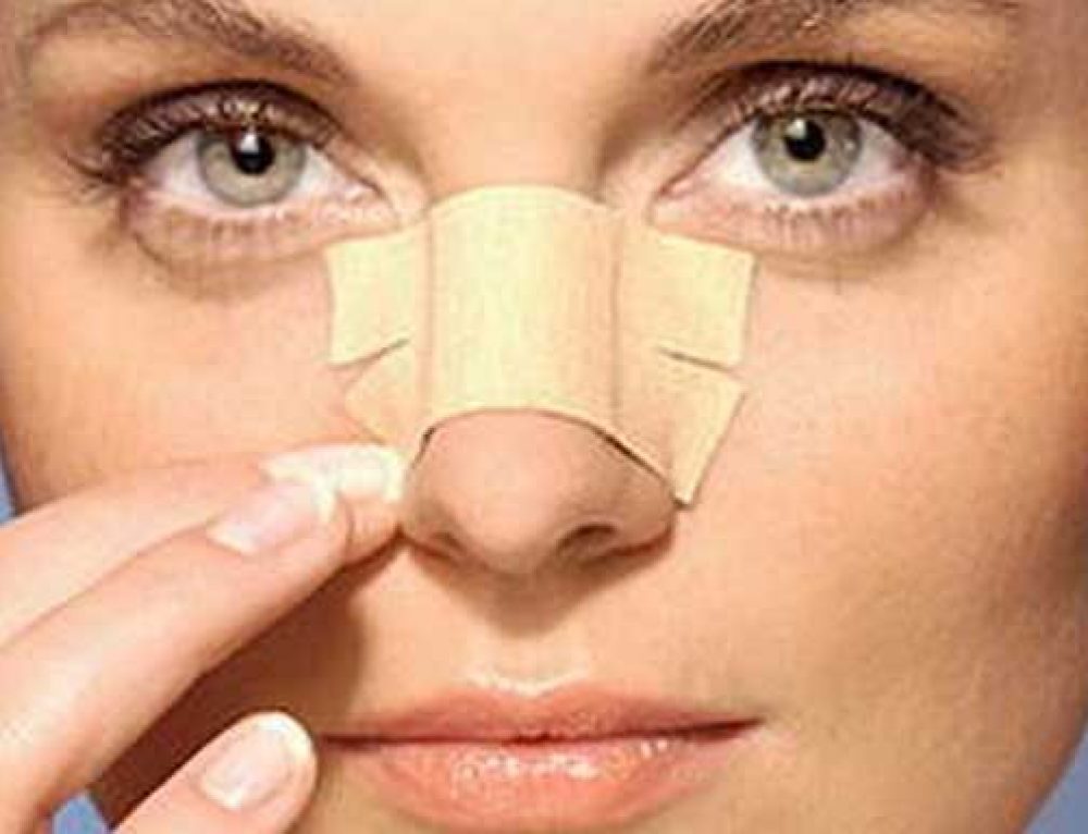 Fleshy Nose Rhinoplasty and results Ziba Medical Tour